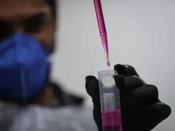 ¿Qué se sabe de la hepatitis desconocida que mantiene en alerta a España? ¿Qué se sabe de la hepatitis desconocida que mantiene en alerta a España?