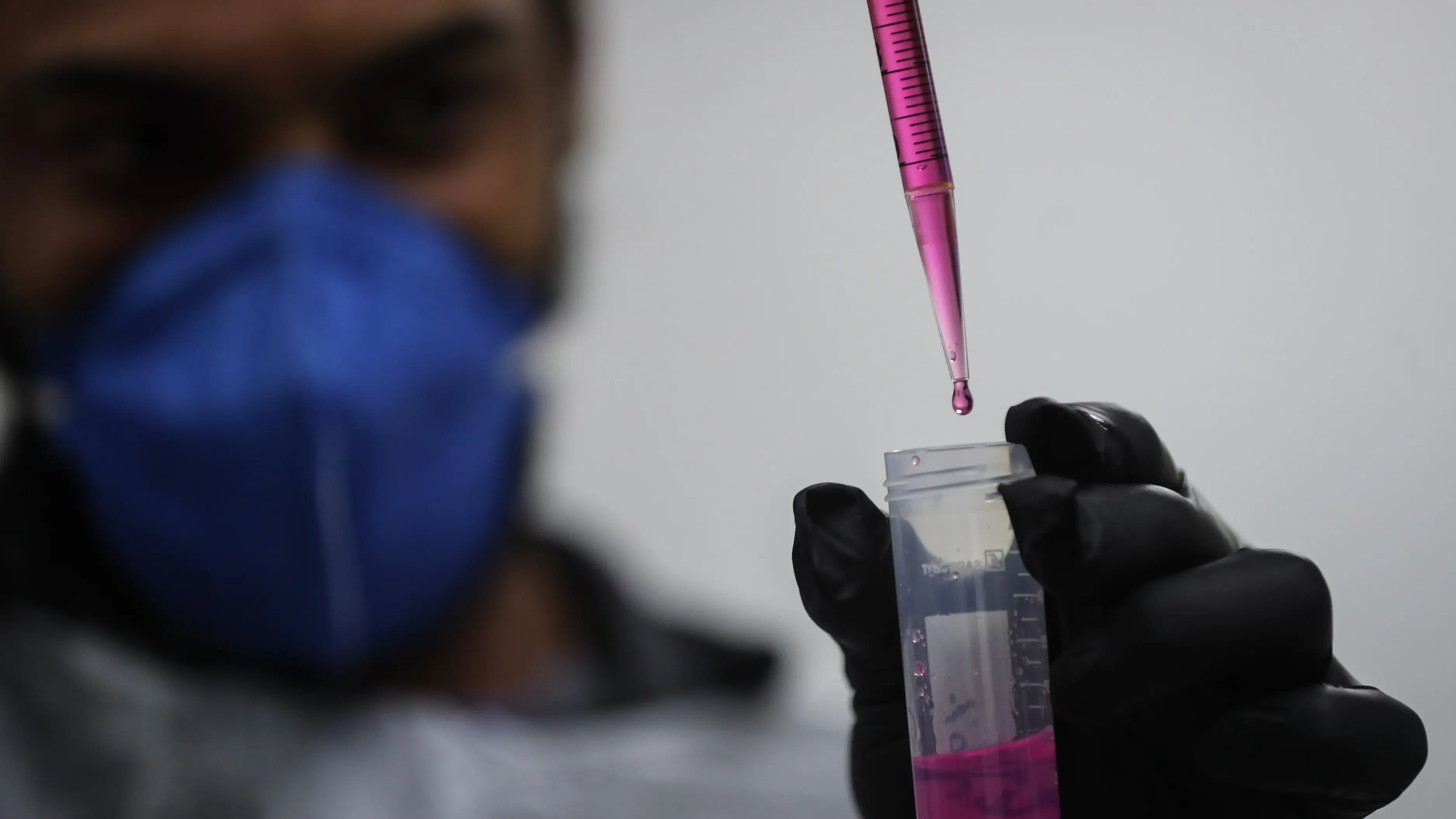 ¿Qué se sabe de la hepatitis desconocida que mantiene en alerta a España? ¿Qué se sabe de la hepatitis desconocida que mantiene en alerta a España?
