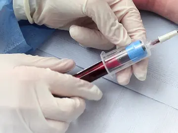 Un hospital español prepara el primer ensayo para tratar el coronavirus persistente con plasma Un hospital español prepara el primer ensayo para tratar el coronavirus persistente con plasma