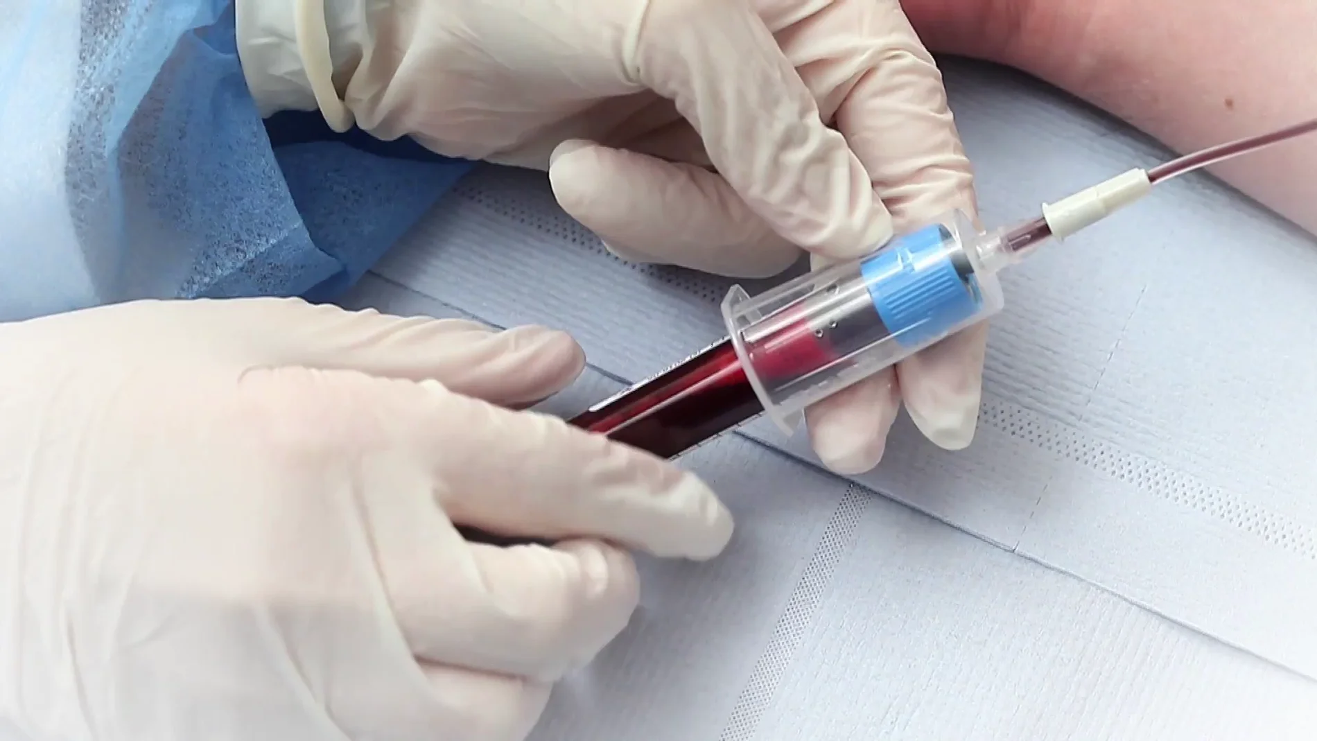 Un hospital español prepara el primer ensayo para tratar el coronavirus persistente con plasma