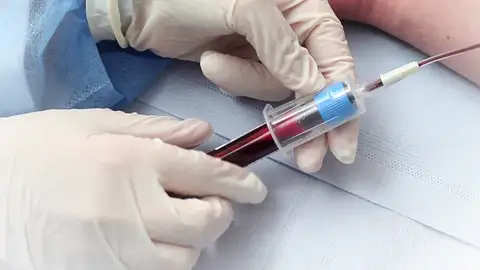Un hospital español prepara el primer ensayo para tratar el coronavirus persistente con plasma Un hospital español prepara el primer ensayo para tratar el coronavirus persistente con plasma