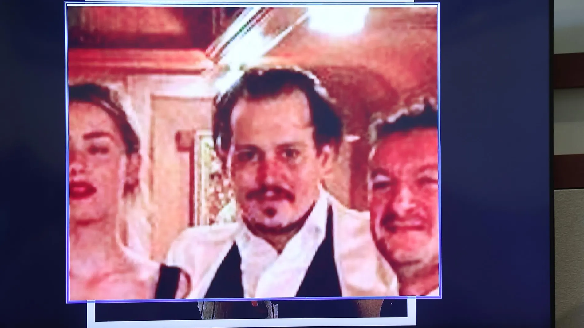 Revelan imágenes de heridas y moratones de Johnny Depp durante su luna de miel con Amber Heard