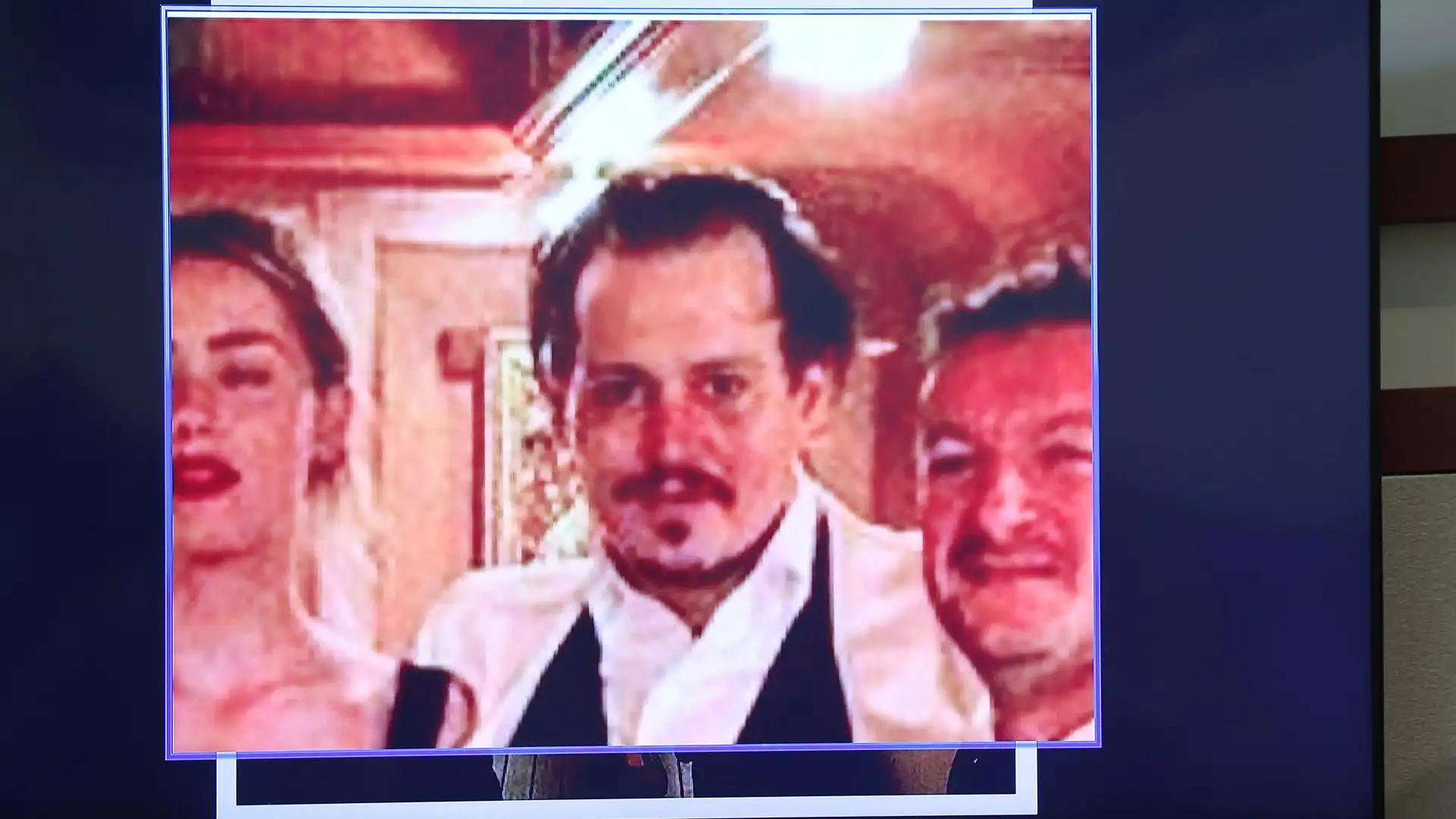 Revelan im&aacute;genes de heridas y moratones de Johnny Depp durante su luna de miel con Amber Heard