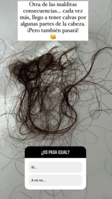 La caída de pelo de Tamara Gorro