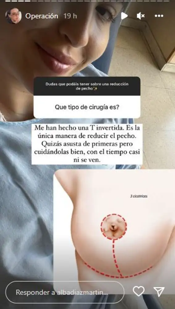 Storie de Instagram de Alba Díaz