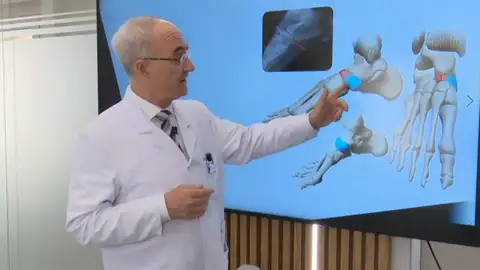 Qué es el síndrome de Müller-Weiss, la lesión crónica que sufre Rafa Nadal en el pie desde 2005 Qué es el síndrome de Müller-Weiss, la lesión crónica que sufre Rafa Nadal en el pie desde 2005