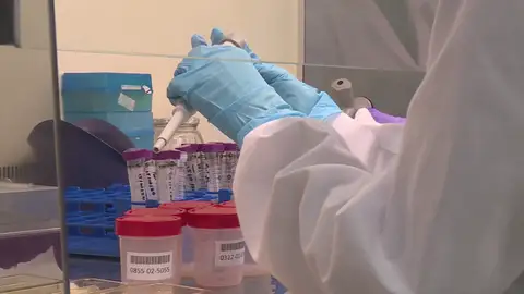 Viruela del mono Viruela del mono