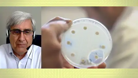 La viruela del mono. La viruela del mono.