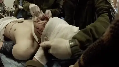 Duras imágenes grabadas por médico en Mariúpol, en la guerra de Ucrania Duras imágenes grabadas por médico en Mariúpol, en la guerra de Ucrania