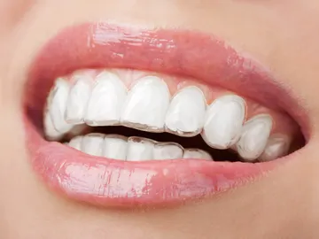 Invisalign Invisalign