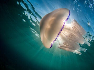 ¿Qué hacer si te pica una medusa? 
