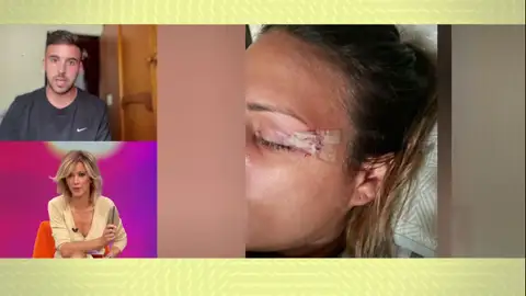 La atropella y la deja herida. La atropella y la deja herida.