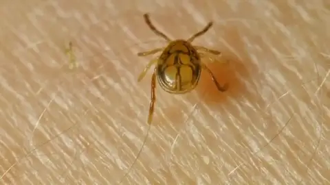 Cómo identificar qué 'bicho' te ha picado: mosquitos, garrapatas y otros insectos Cómo identificar qué 'bicho' te ha picado: mosquitos, garrapatas y otros insectos