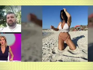 Víctima de la cirugía estética. Víctima de la cirugía estética.