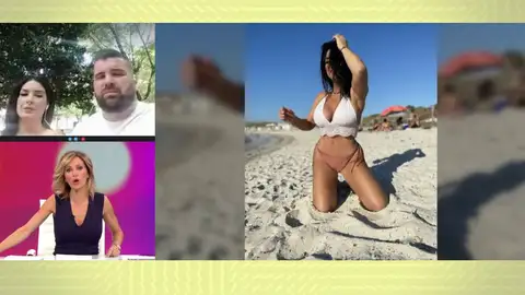 Víctima de la cirugía estética. Víctima de la cirugía estética.