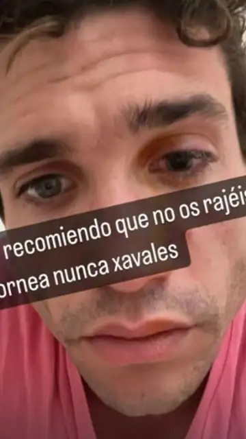 Jaime Lorente muestra su accidente laboral Jaime Lorente muestra su accidente laboral