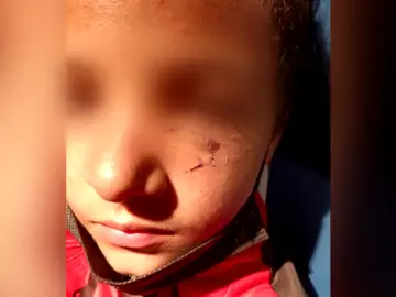 Un niño de 11 años en Tenerife es agredido por defender a su abuelo