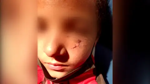 Un niño de 11 años en Tenerife es agredido por defender a su abuelo Un niño de 11 años en Tenerife es agredido por defender a su abuelo