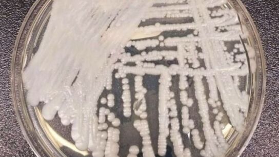 Candida Auris, el hongo 'asesino' resistente a los f&aacute;rmacos
