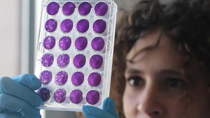 C&oacute;mo evolucionan las nuevas variantes de covid d&iacute;a a d&iacute;a en el organismo
