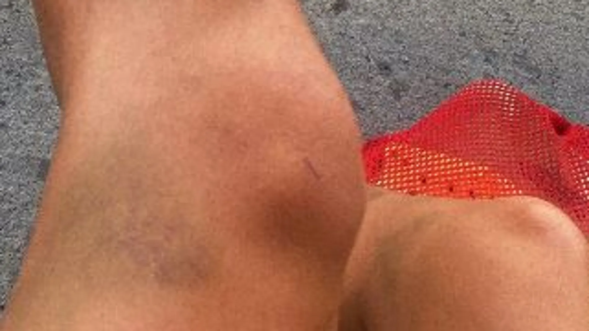 Mary-Sophie Harvey muestra sus lesiones tras haber sido drogada durante los Mundiales de natación en Budapest