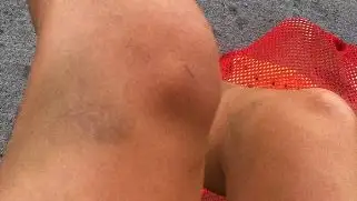 Mary-Sophie Harvey muestra sus lesiones tras haber sido drogada durante los Mundiales de natación en Budapest Mary-Sophie Harvey muestra sus lesiones tras haber sido drogada durante los Mundiales de natación en Budapest
