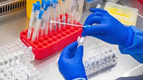 ¿Cómo se contagia la viruela del mono? ¿Cómo se contagia la viruela del mono?