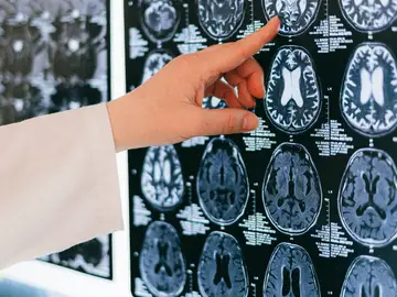 Una radiografía del cerebro humano