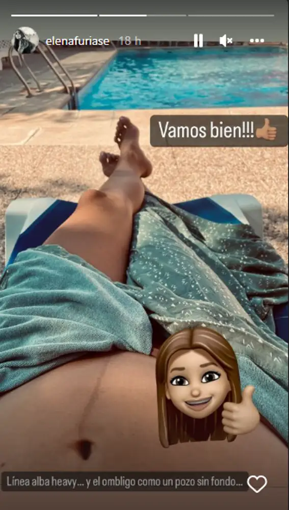 Elena Furiase