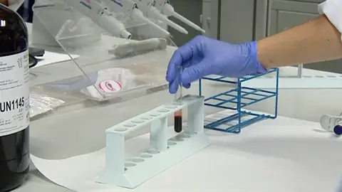 Pruebas de análisis de éxtasis líquido Sumisión química