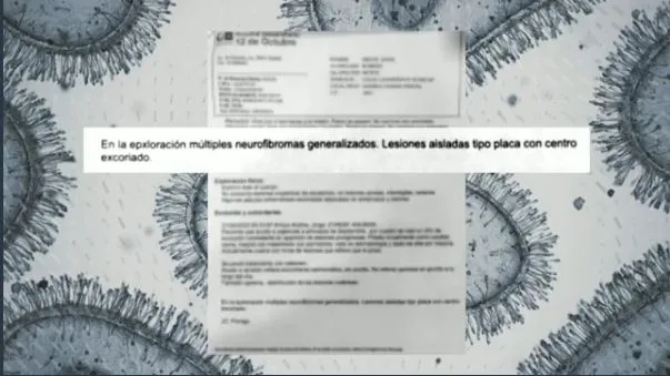 Informe m&eacute;dico de Miguel