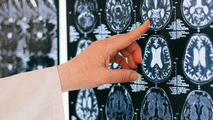 Im&aacute;genes del cerebro