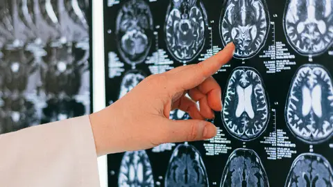 Imágenes del cerebro Imágenes del cerebro