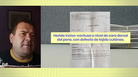 Herido en el pene. Herido en el pene.