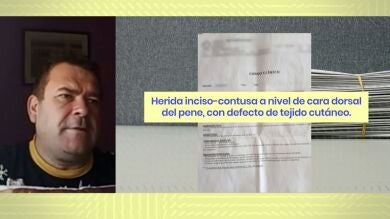 Un perro le muerde el pene en una terraza de Ferrol: 