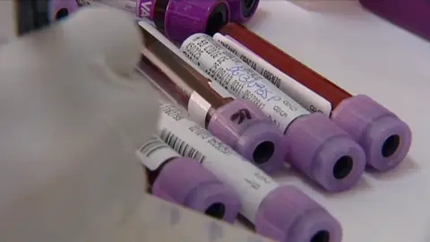 Pruebas de análisis de sangre Pruebas de análisis de sangre