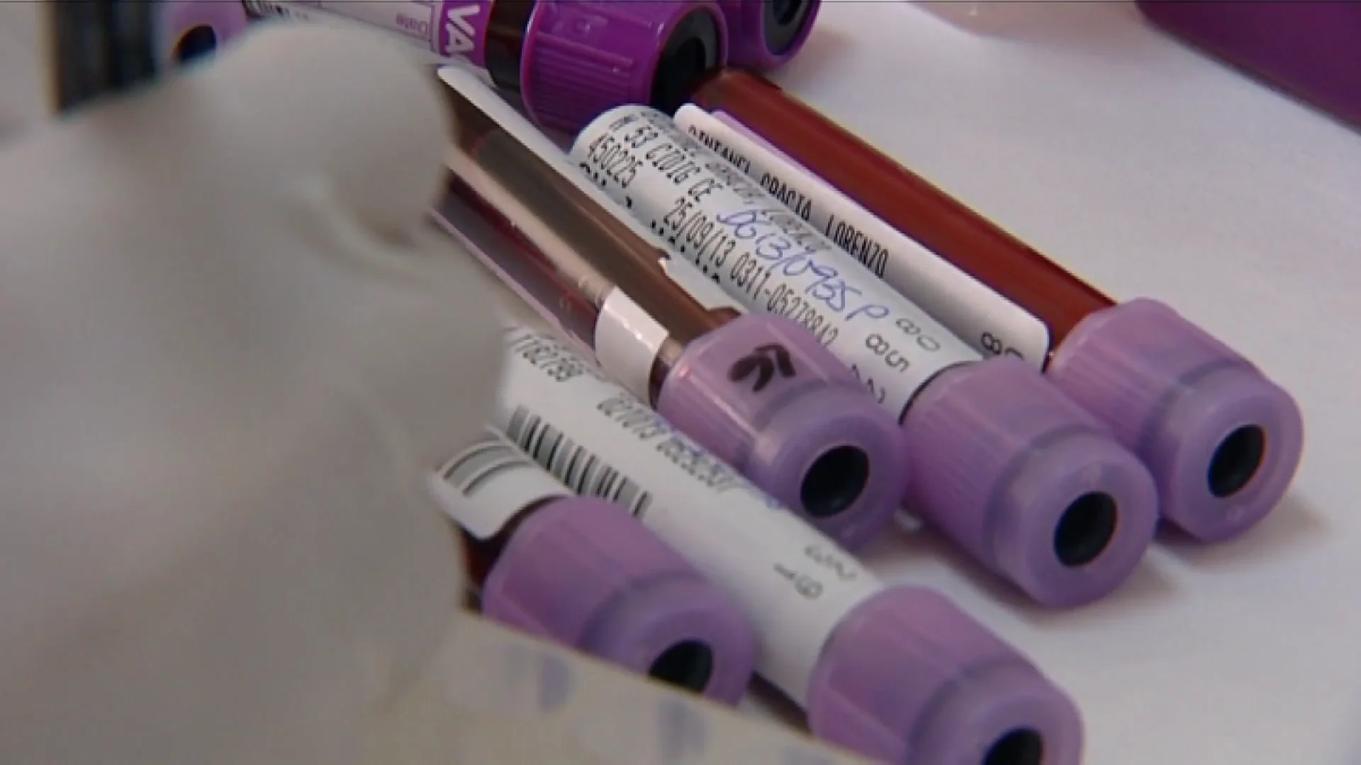 Pruebas de análisis de sangre Pruebas de análisis de sangre