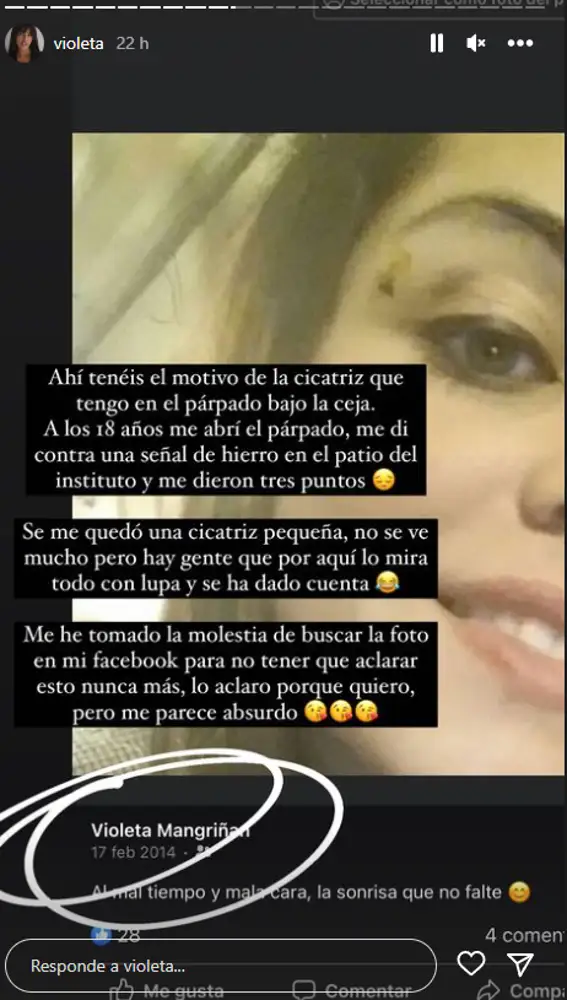 Violeta desvela el motivo de la cicatriz que tiene en el párpado