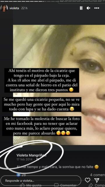 Violeta desvela el motivo de la cicatriz que tiene en el párpado