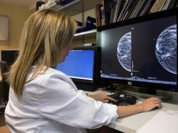 Imagen de archivo de una mamografía