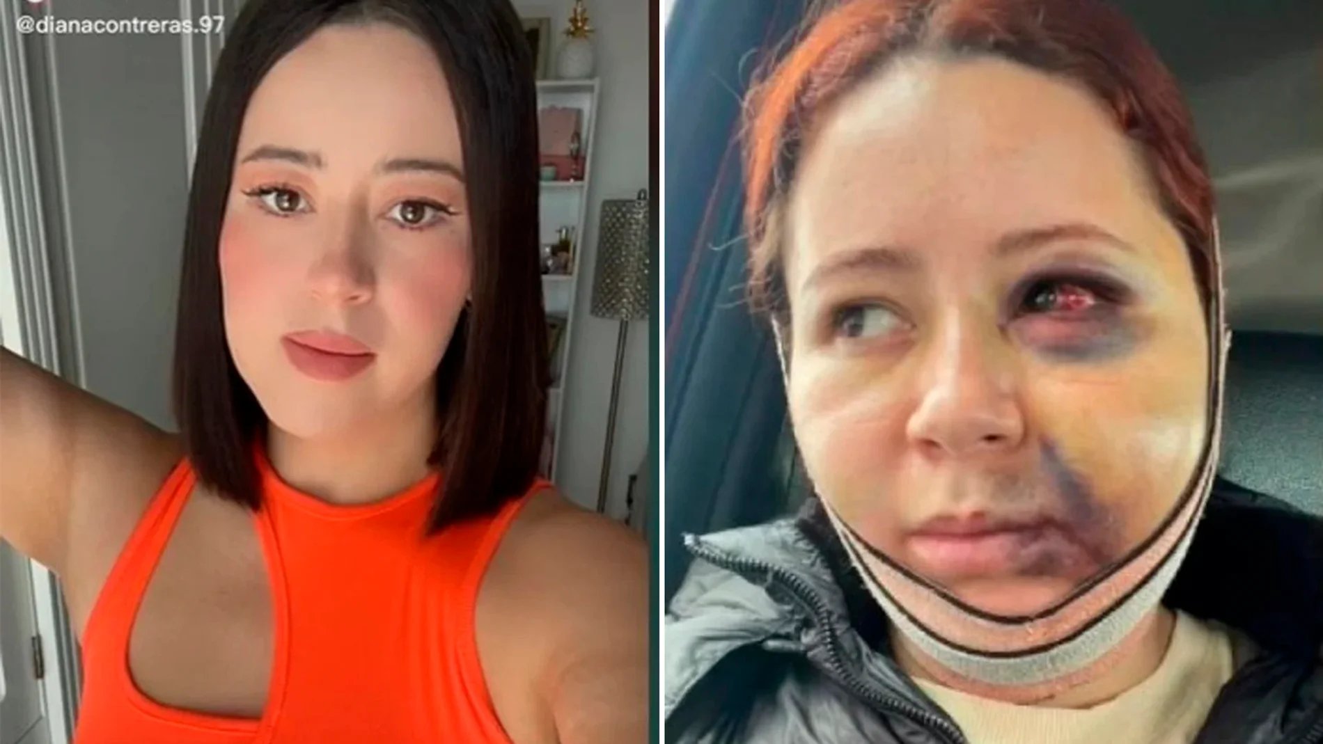 El antes y después de la joven en TikTok El antes y después de la joven en TikTok