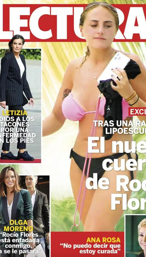 Rocío Flores, pillada en bikini tras su lipoescultura