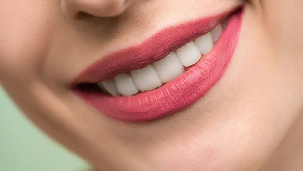 Sonrisa con dientes blancos