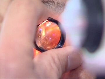 Imagen de un oftalmólogo poniendo una lente a un paciente