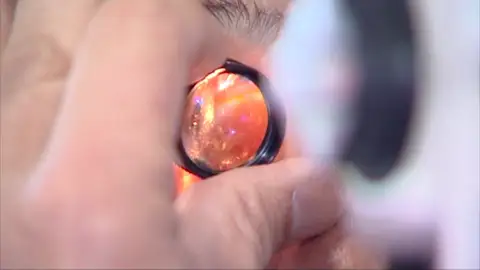 Imagen de un oftalmólogo poniendo una lente a un paciente Imagen de un oftalmólogo poniendo una lente a un paciente