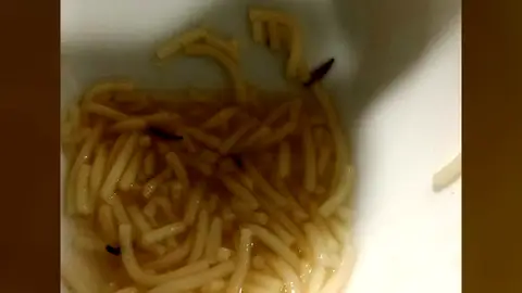 Gusanos encontrados por el personal del hospital León