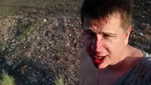 Agredido por un okupa. Agredido por un okupa.