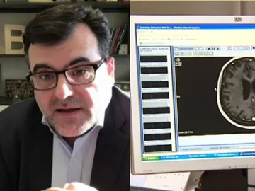 Eduard Batlle, responsable del laboratorio del cáncer colorrectal del instituto de investigación biomédica y ha liderado esta investigación publicada en la revista Nature. Eduard Batlle, responsable del laboratorio del cáncer colorrectal del instituto de investigación biomédica y ha liderado esta investigación publicada en la revista Nature.
