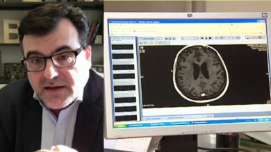 Así es el descubrimiento científico que puede evitar recaídas en el cáncer de colon: 