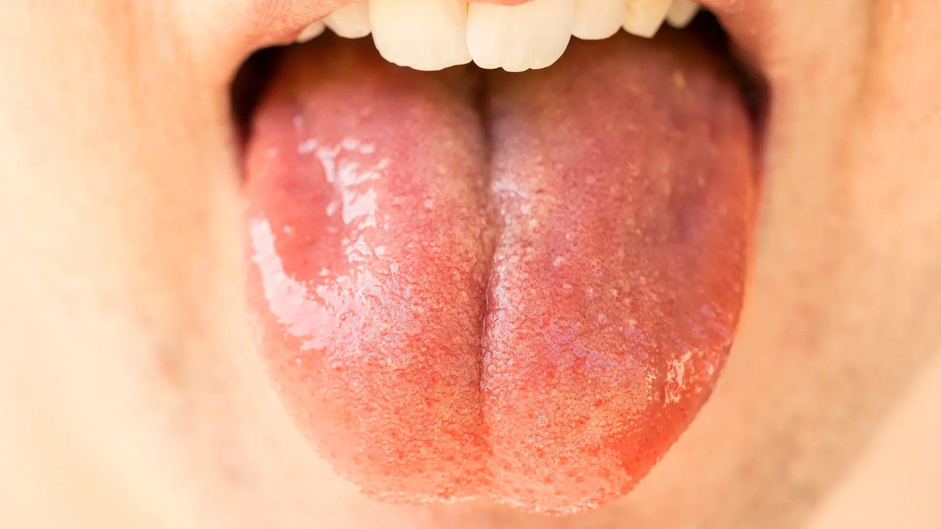 Lengua Lengua
